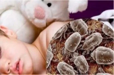 Foto de un bebé con ácaros para meter miedo con la salud